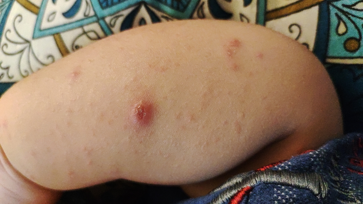 ظهر جمعه باشه، از مریضداری خسته باشی، بیخوابی کشیده باشی ولی خوابت هم نبره! ظهر جمعه باشه، از مریضداری خسته باشی، بیخوابی کشیده باشی ولی خوابت هم نبره!