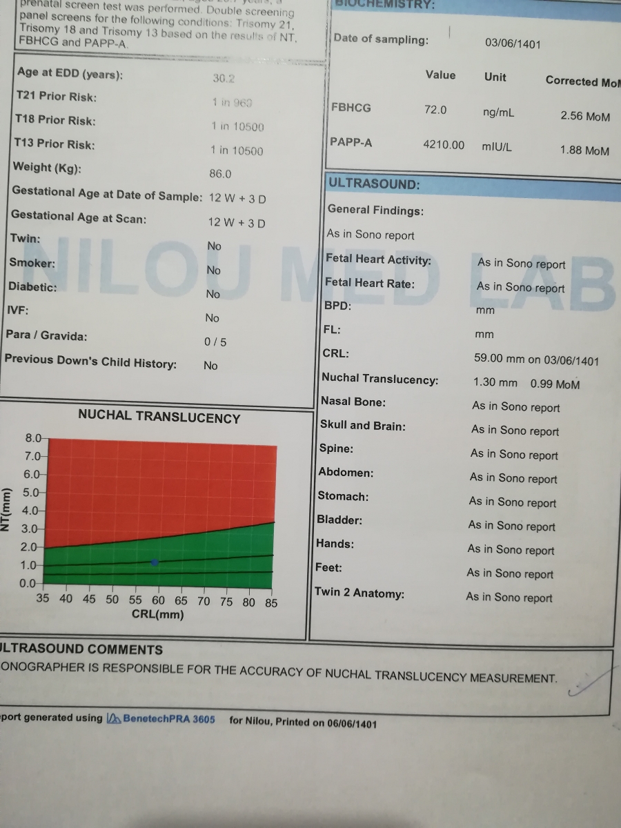 تفسیر آزمایش وسونو nt تفسیر آزمایش وسونو nt