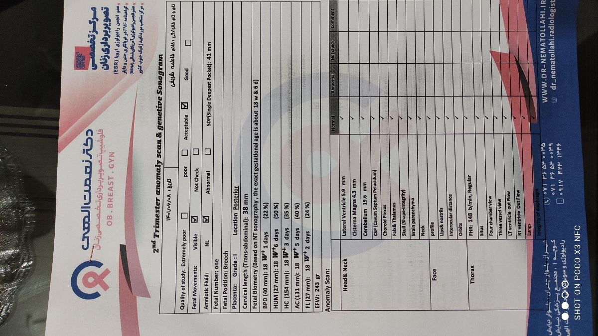 غربالگری دوم سونو و آزمایش