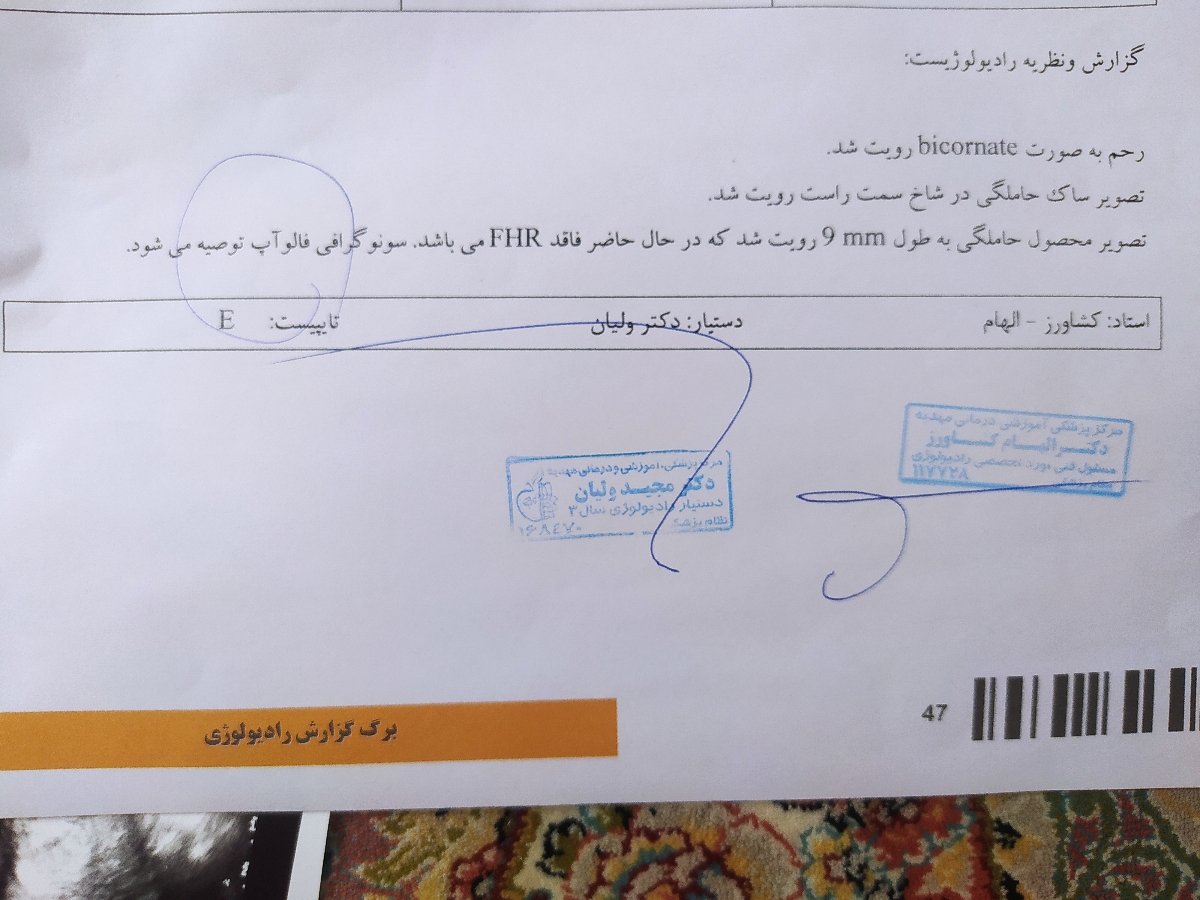 دیده نشدن فعال پل و مغاییرت داشتن تاریخ سونو با تاریخ پریودی و داشتن رحم دوشاخ