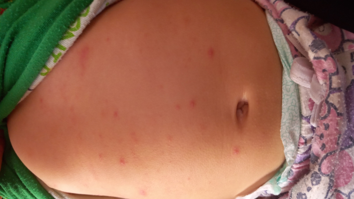 دکتر جان همه جاش اینطوری شده
دکتر گفت داخل دهان و گلوش هم از اینا دراورده دکتر جان همه جاش اینطوری شده
دکتر گفت داخل دهان و گلوش هم از اینا دراورده