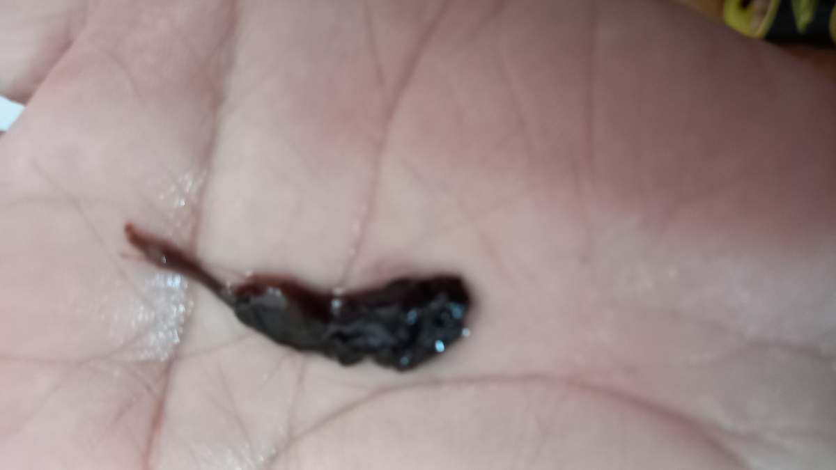 ❓️دفع لخته خون هفته ۳۷