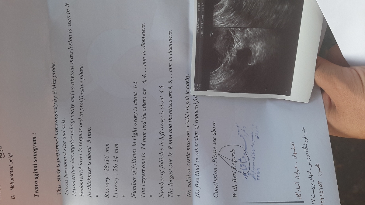 تفسیر سونو وازینال فولیکول غالب روز دهم سیکل