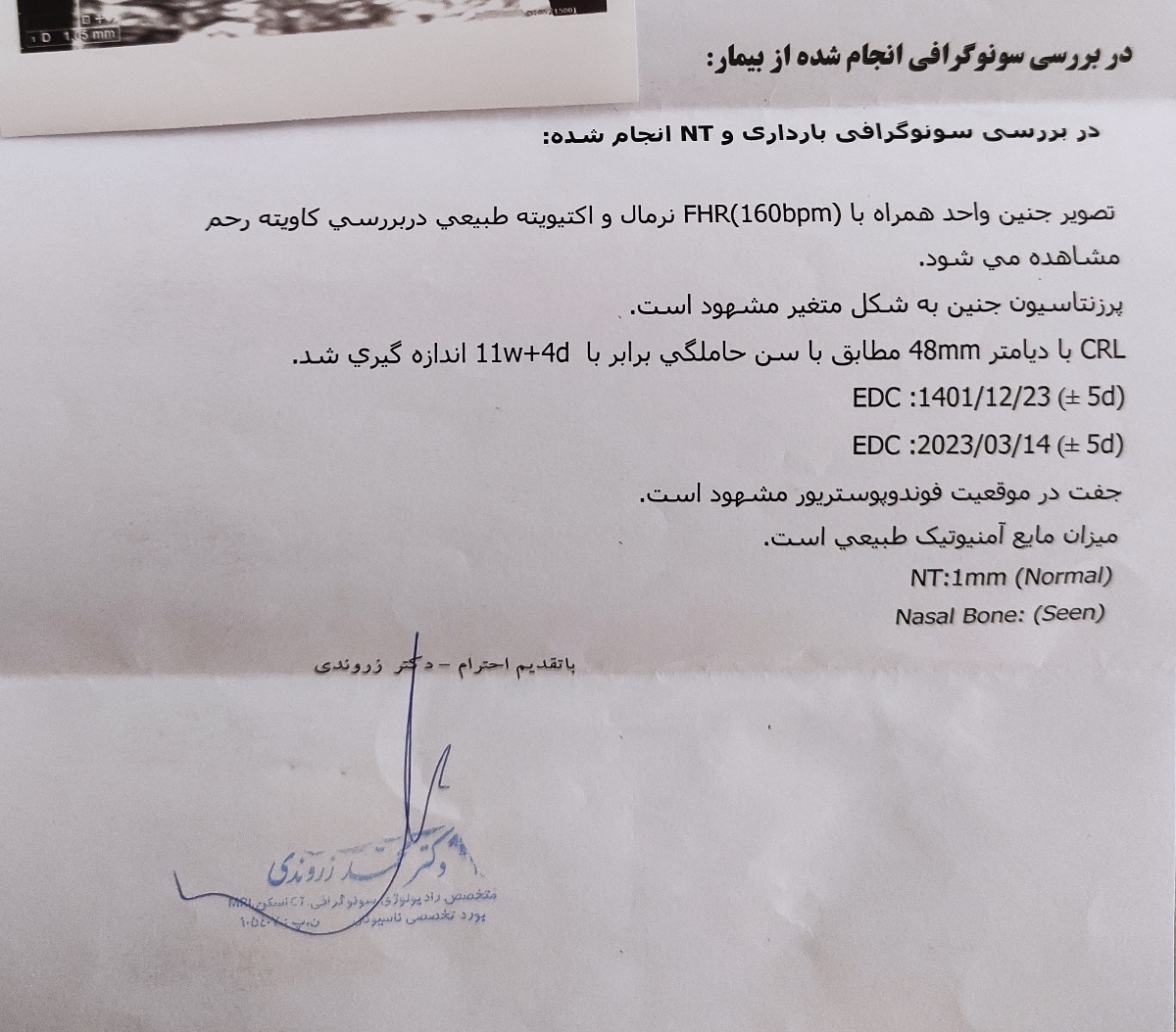 آزمایشات غربال گری اول