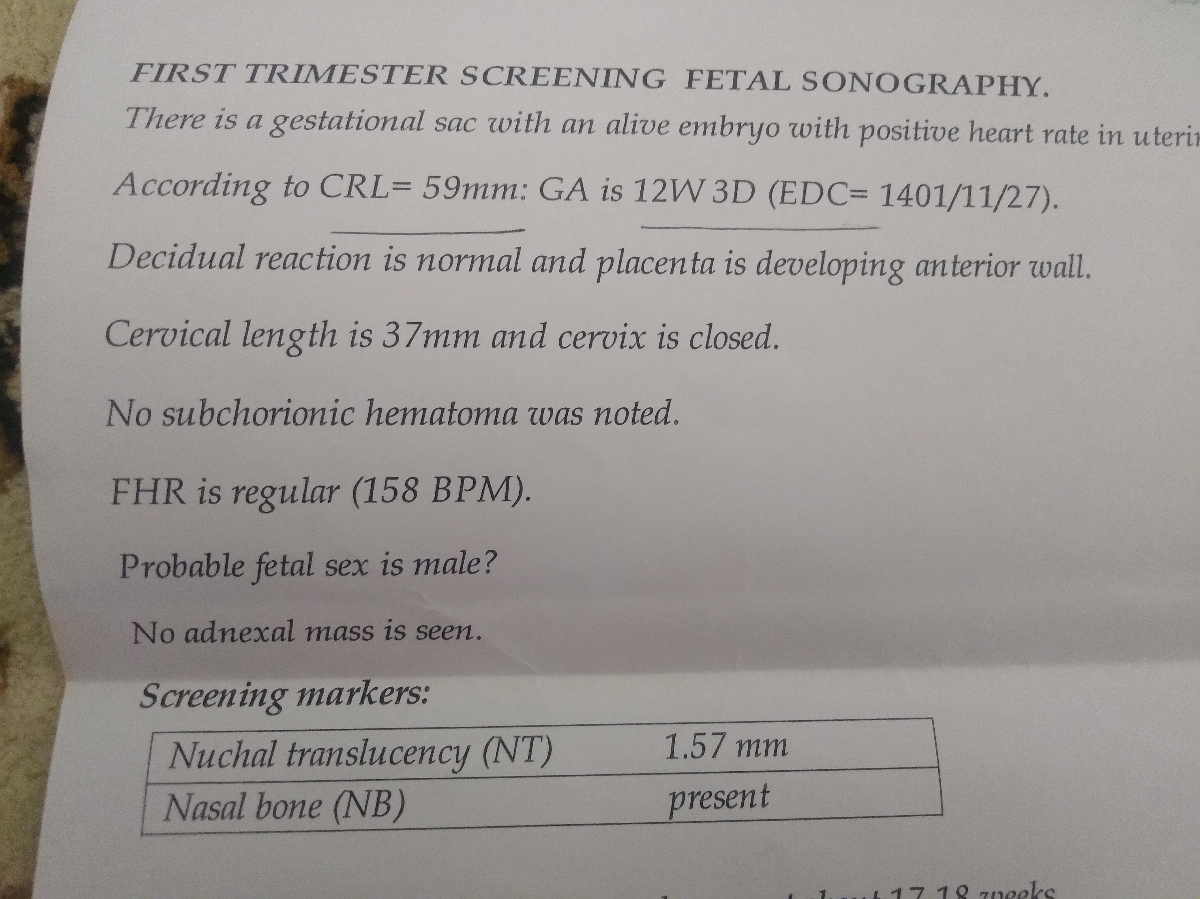 کمردرد وسرگیجه در بارداری