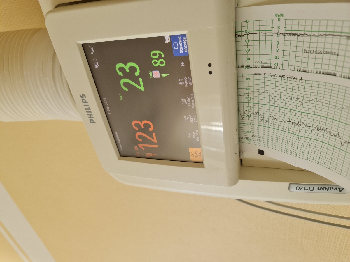 بله گفتن که همه چی خوبه البته هنوز سونو نکردن گفتن بعد از این حتمن سونو میکنن ممنون از راهنماییتون