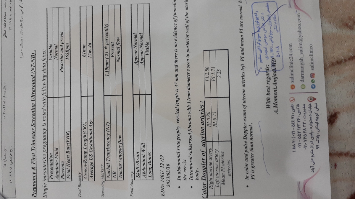 آزمایش غربالگری ۱۲هفتگی و احتمال سندرم داشتن زیاده