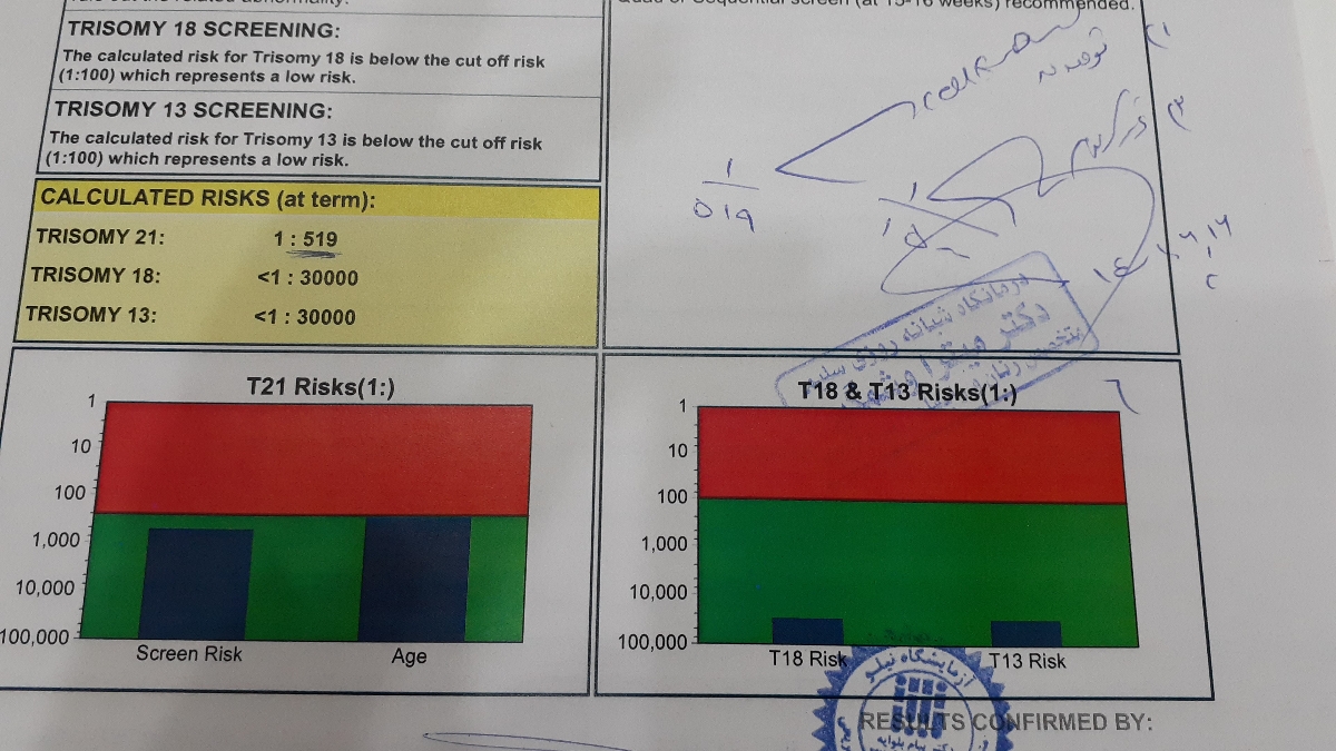 آزمایش غربالگری ۱۲هفتگی و احتمال سندرم داشتن زیاده