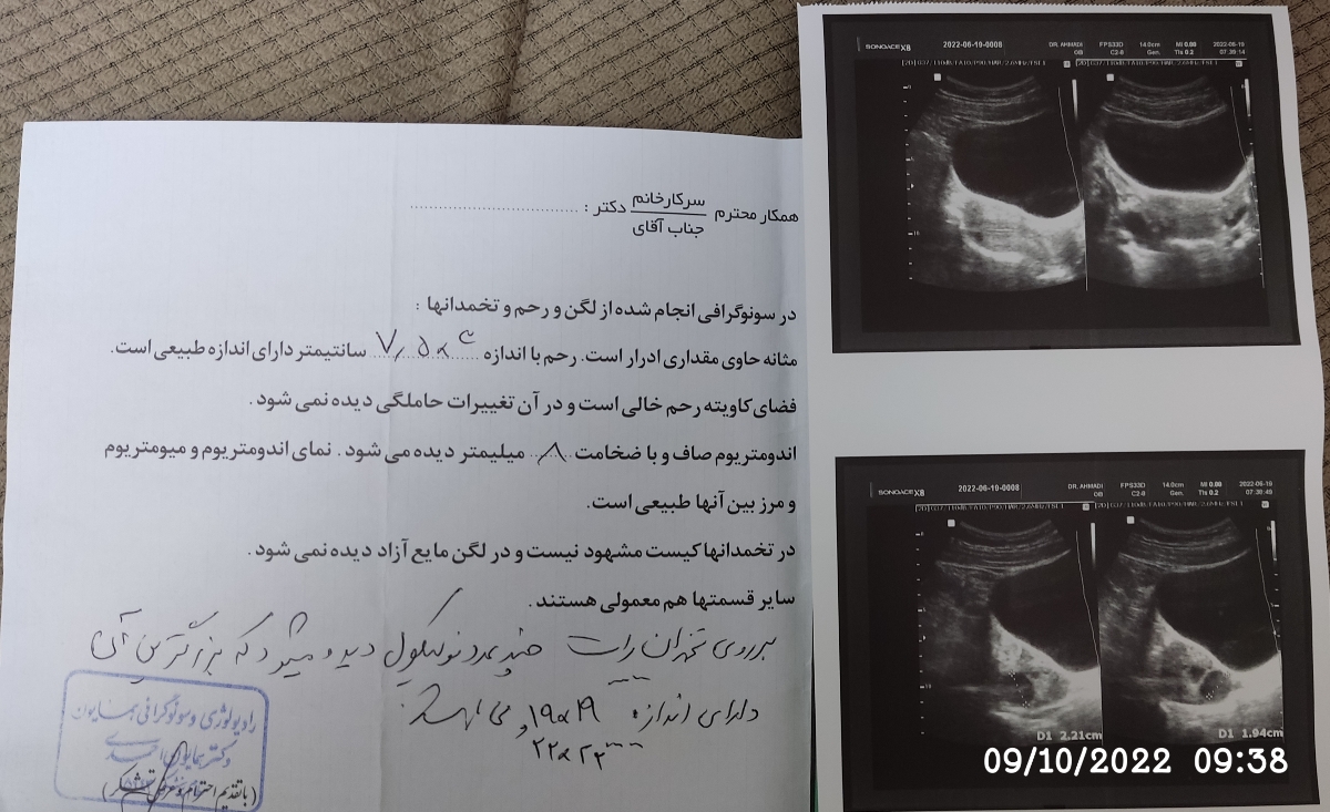 سونوگرافی رحم تخمدان و اندازه فولیکول روز ۱۳