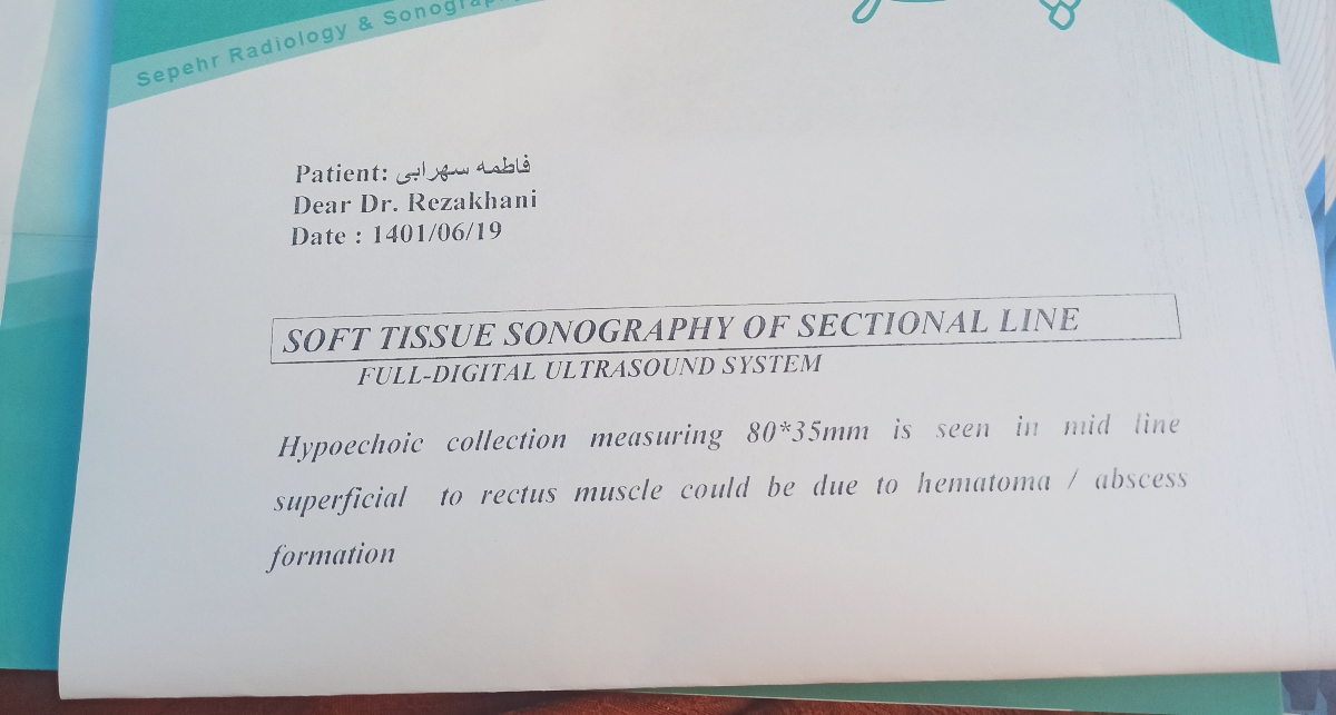 سونوگرافی محل سزارین و احتمال کالکشن