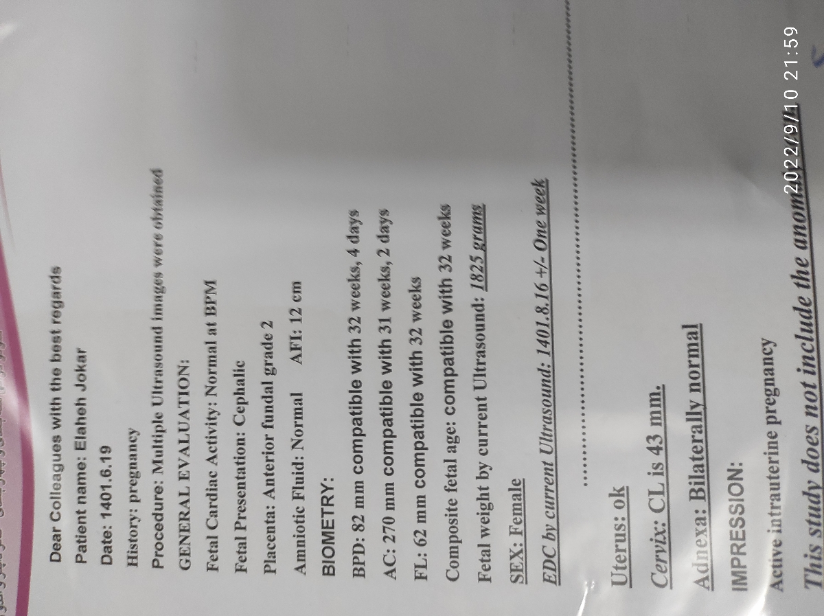 سونوگرافی حاملگی هفته سی و دو