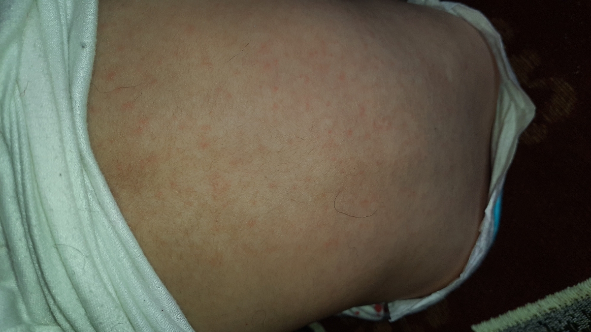 این پشتشه بدنش وگردن و صورتشم هست