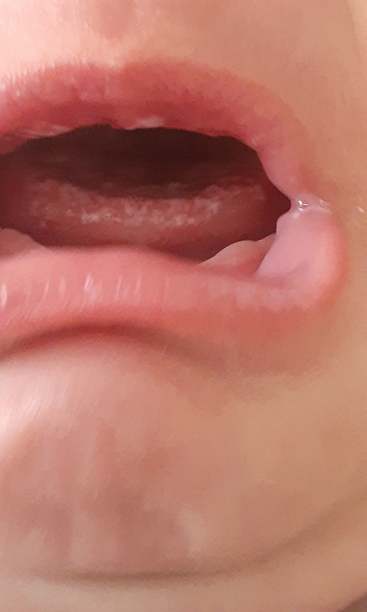 اینا چیه توی دهن دخترم