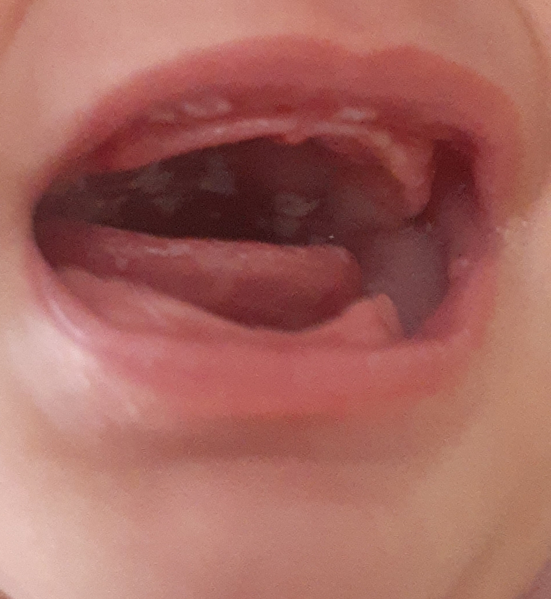 اینا چیه توی دهن دخترم