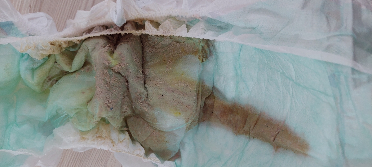 تغییر رنگ و قوام مدفوع و بیقراری