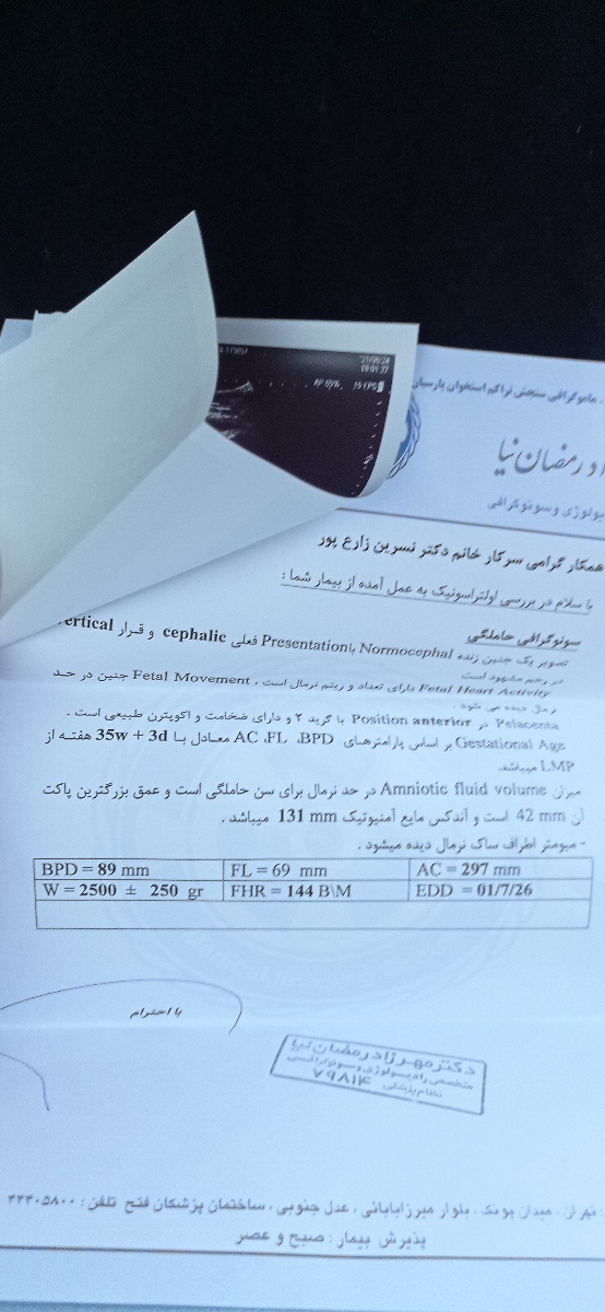 کاهش مایع آمینیوتیک در بارداری