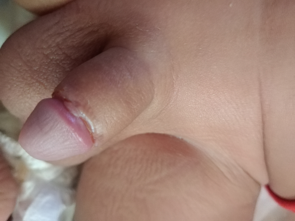 اینجای آلتش اینجوریه یعنی چسپندگی داره؟ 