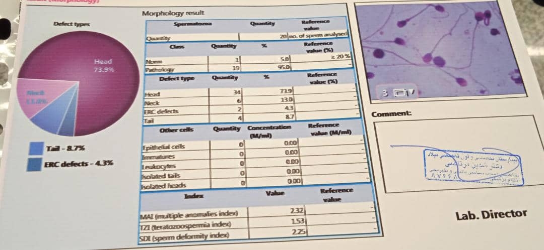 متخصصای تفسیر آز اسپرم