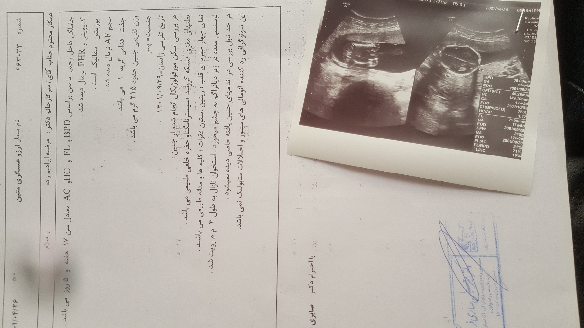 سلام خانوم دکتر اگه میشه سونوی منو تفسیر کنید