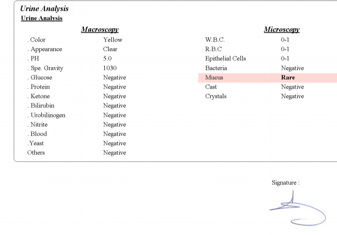 تفسیرآزمایش چکاب همسرم