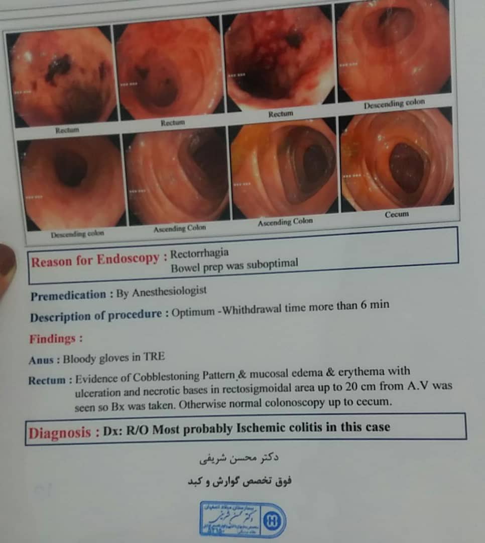 لوکونوسکوپی بابای دوستموتفسیرمیکنید