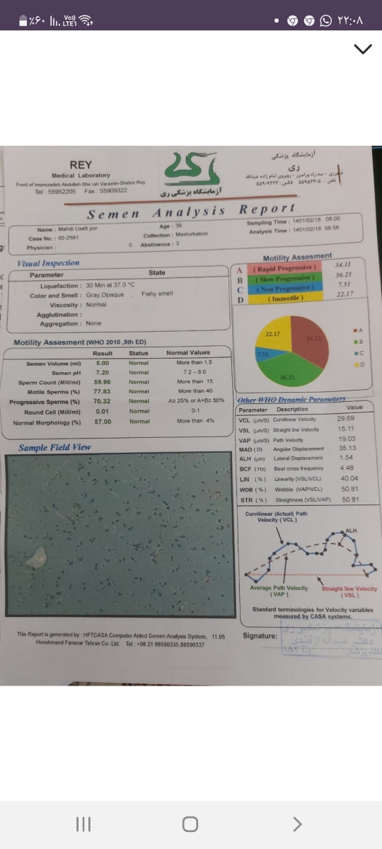 باز کردن لوله با لاپاراسکوپی یا آی وی اف