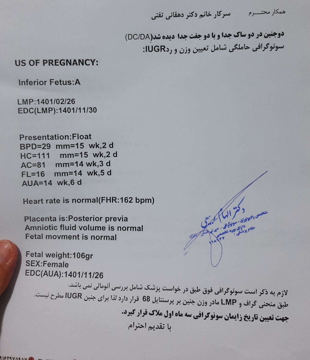 جفت سرراهی اگر خلفی بشه امکان داره دوباره بیاد پایین