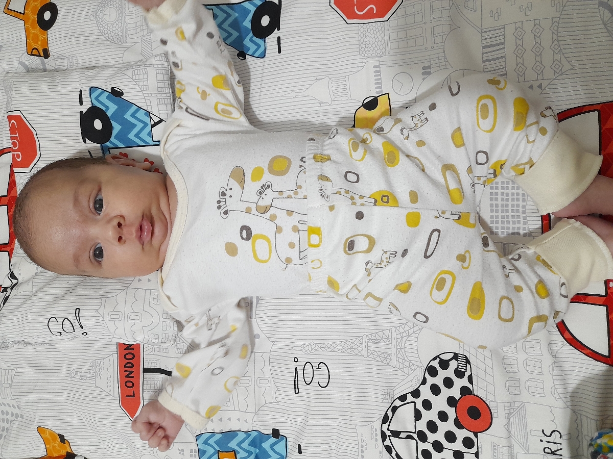 کبودی رو نمیدونم
ولی انگار ملحفه رختخواب بچه هومون یک شکله😅🥰🥰😅😅