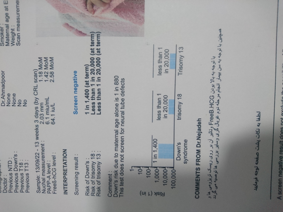 اعداد غربال گری اول
