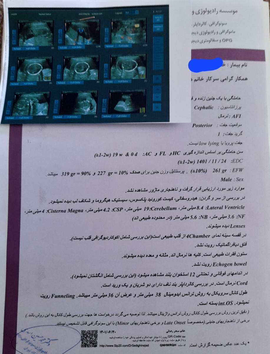 تفسیر سونو آنومالی اسکن