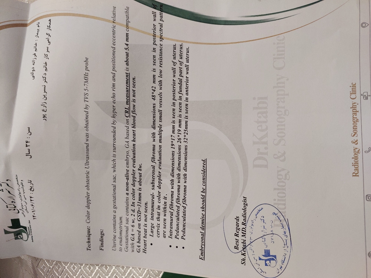 این اخرین سونو گرافی
