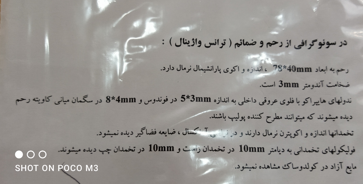 این نتیجه هستش ولی نمی‌دونم چجوریه