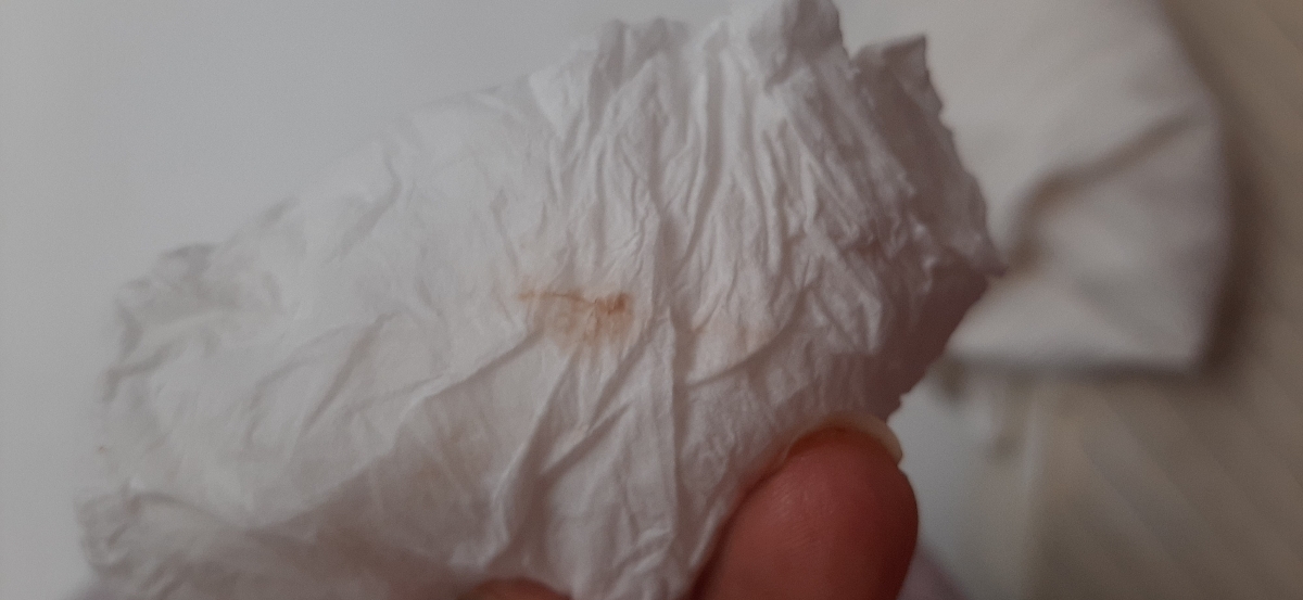 لکه بینی بعد از ازمایش بتا