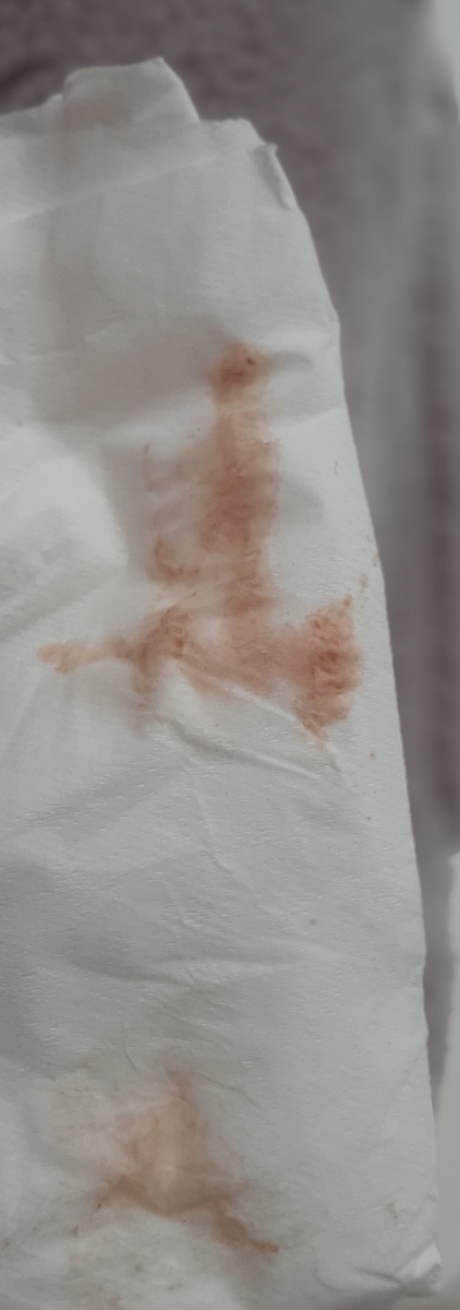 لکه بینی بعد از ازمایش بتا