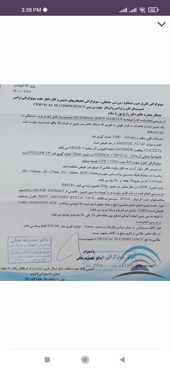 محاسبه تاریخ زایمان بر حسب سزارین انتخابی
