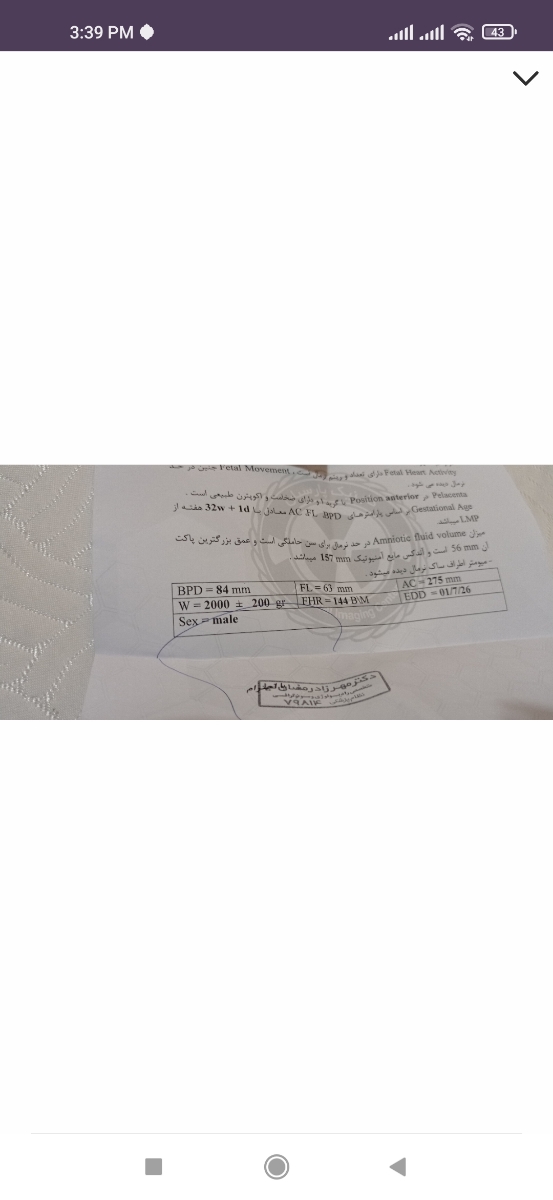 محاسبه تاریخ زایمان بر حسب سزارین انتخابی