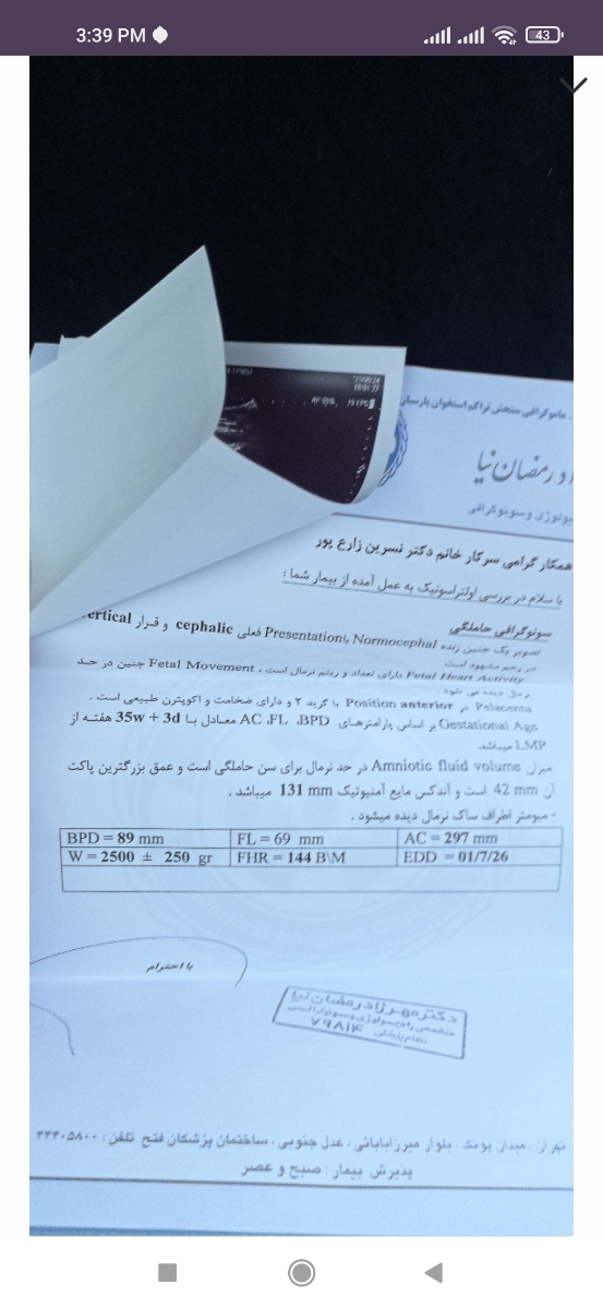 محاسبه تاریخ زایمان بر حسب سزارین انتخابی
