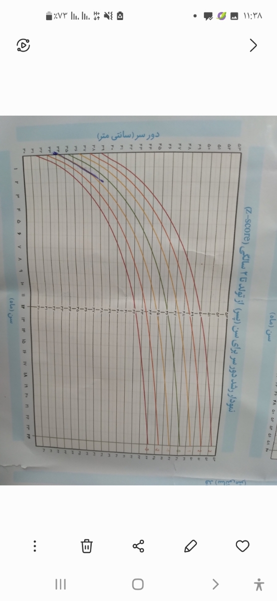 سلام خوبین علت رشد کند نوزاد سلام خوبین علت رشد کند نوزاد