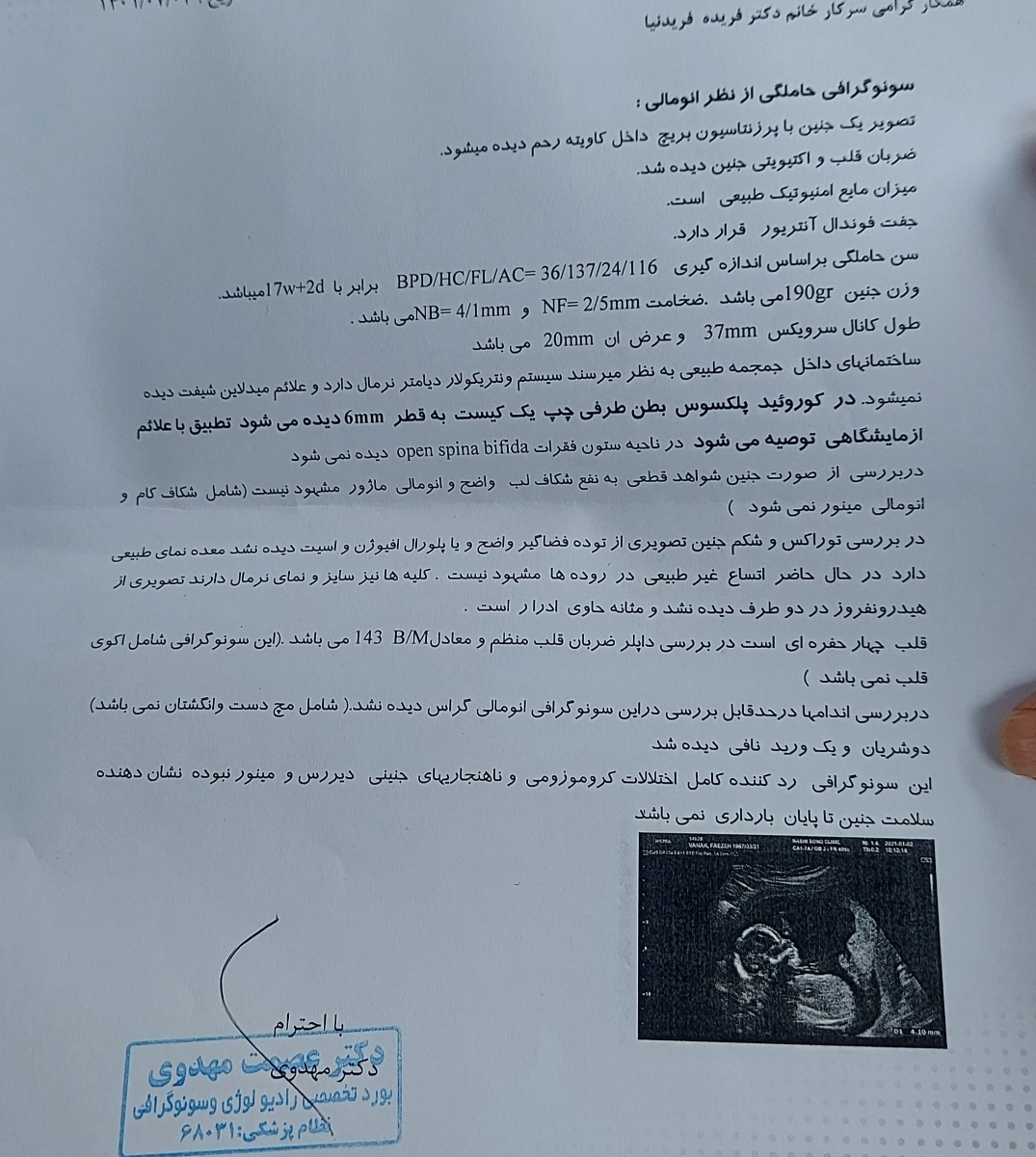 سفت شدن شکم در هفته ۱۸