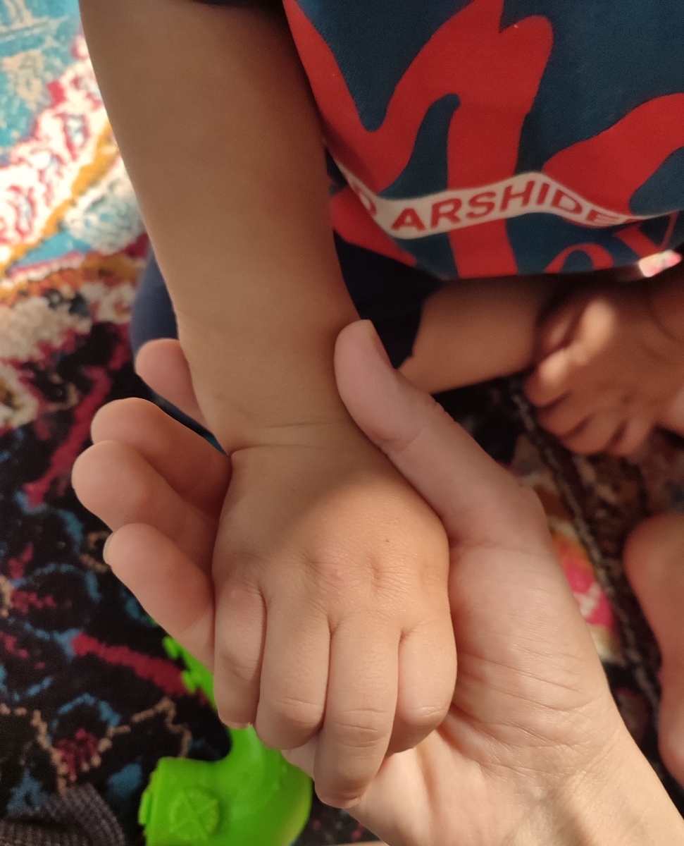 اینا آبله مرغانه رو پاها و دور دهان پسرم؟؟دکترش تعطیلع، پزشک عمومی گف آبلس