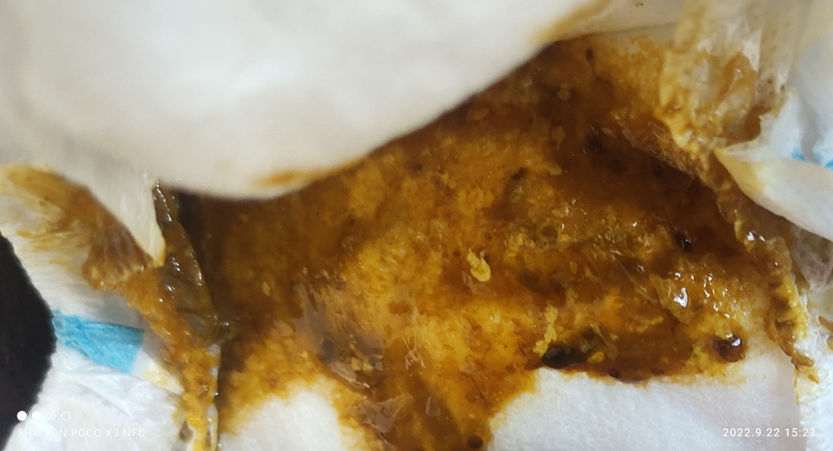 مدفوع نوزاد ده روزه+عکس،عذر میخام بخاطر عکس🌹