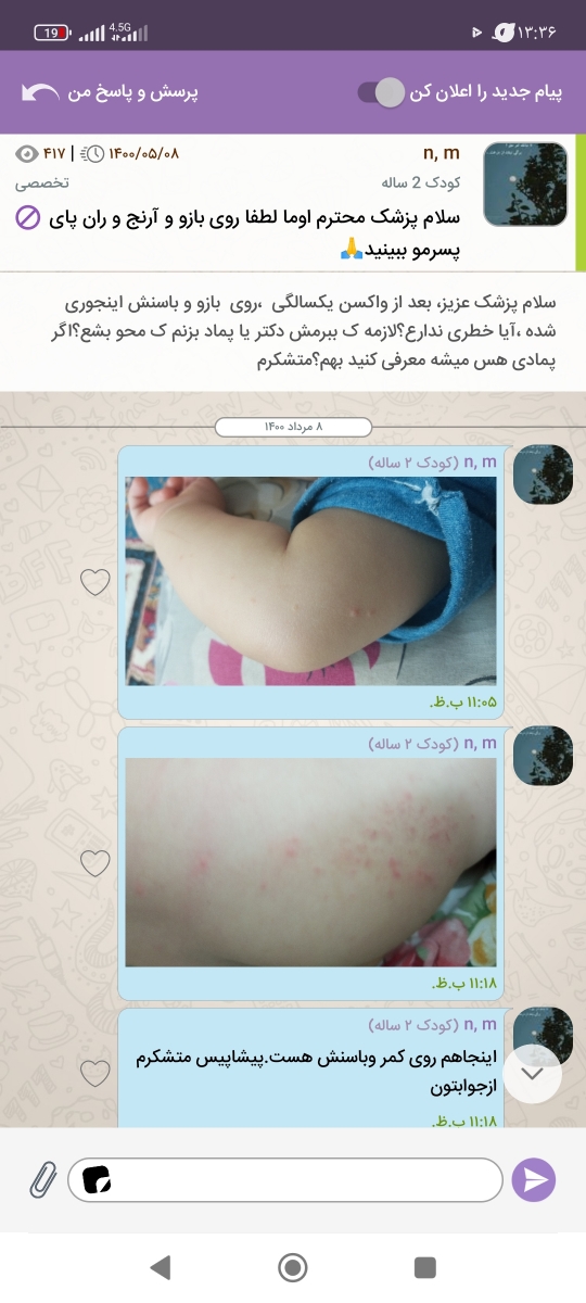 اینا آبله مرغانه رو پاها و دور دهان پسرم؟؟دکترش تعطیلع، پزشک عمومی گف آبلس