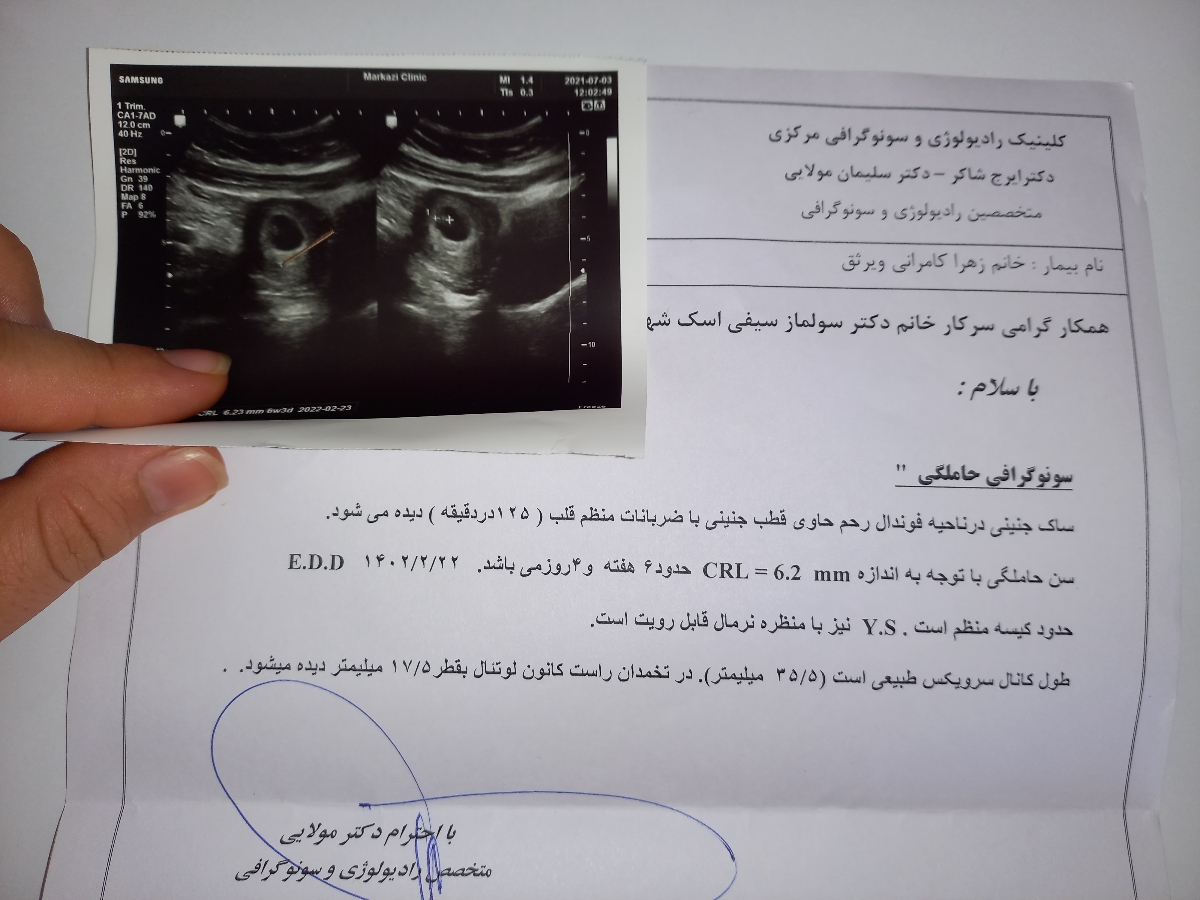 اولین سونو بارداری من