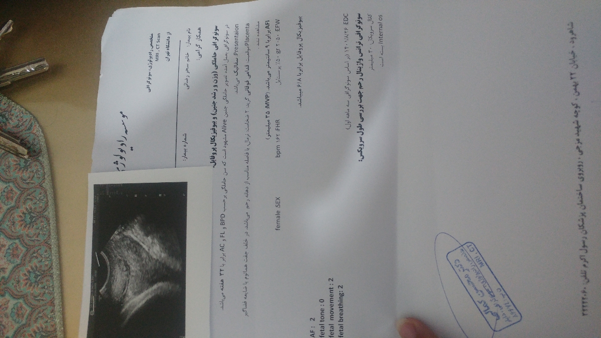 سکسکه خیلی زیاد جنین ...فوری