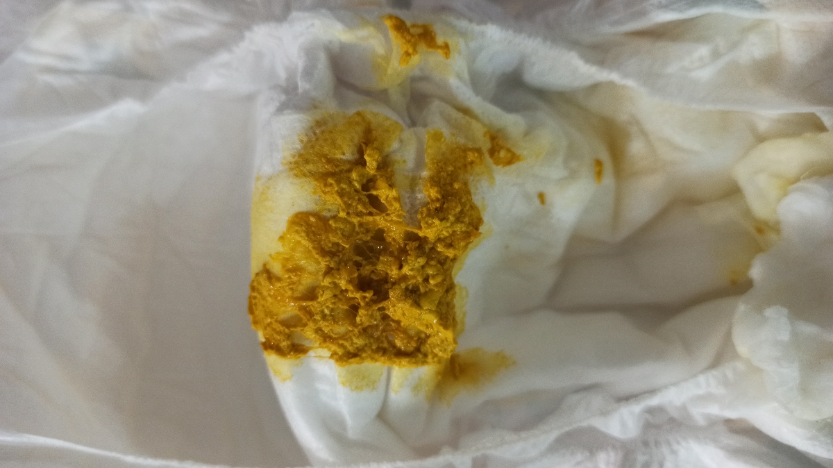 مدفوع نوزاد ۹ روزه