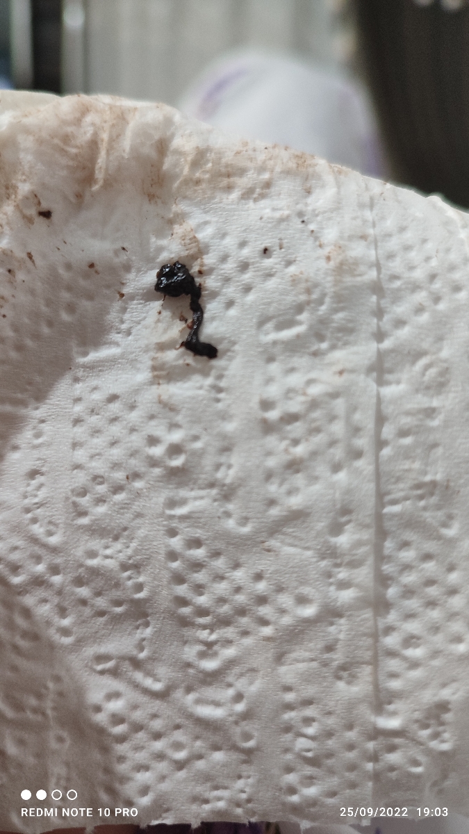 لخته قهوه ای رنگ هفته۱۷