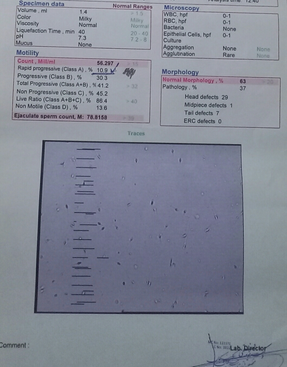 تفسیر آزمایش اسپرم و سونوگرافی رحم تفسیر آزمایش اسپرم و سونوگرافی رحم