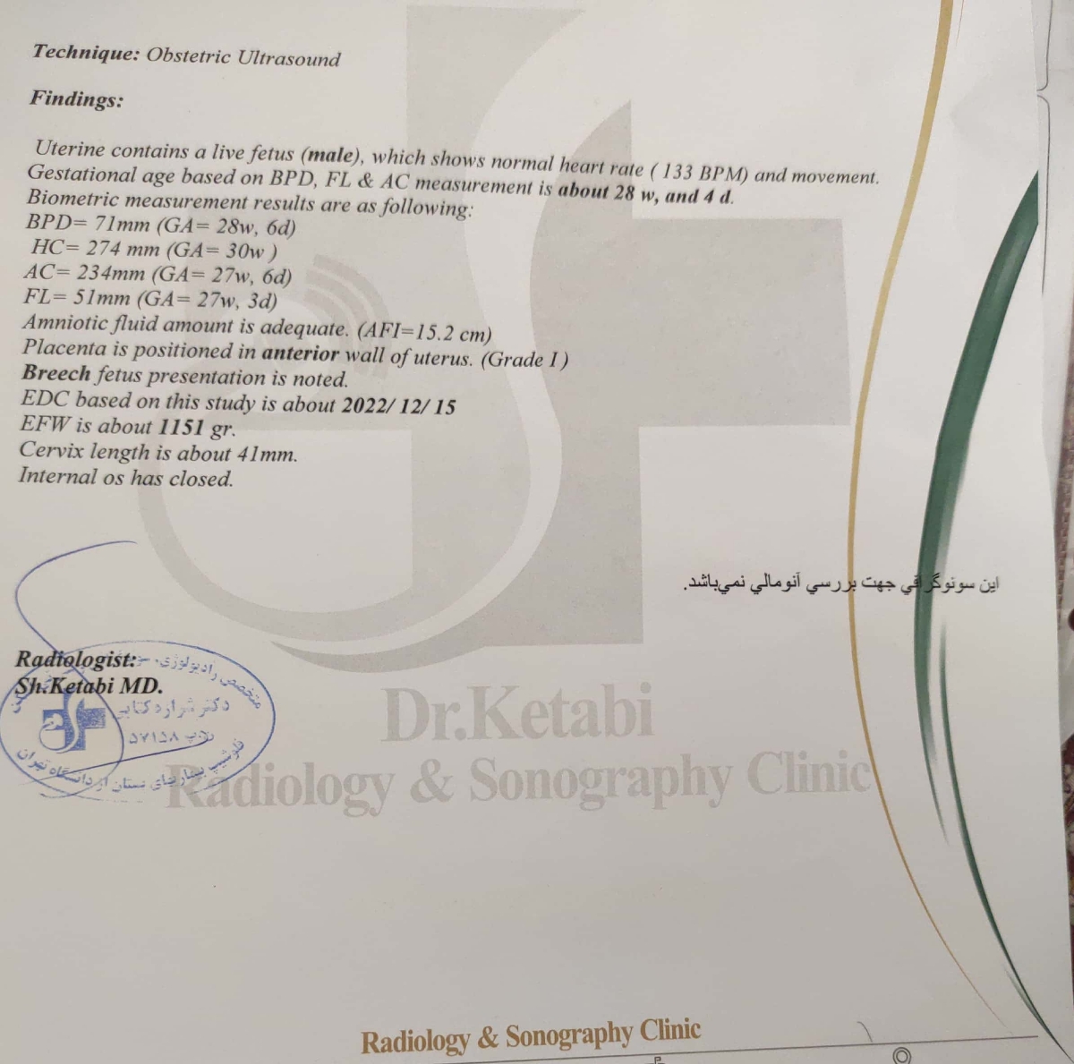 قبلی کج اومده بود:| قبلی کج اومده بود:|