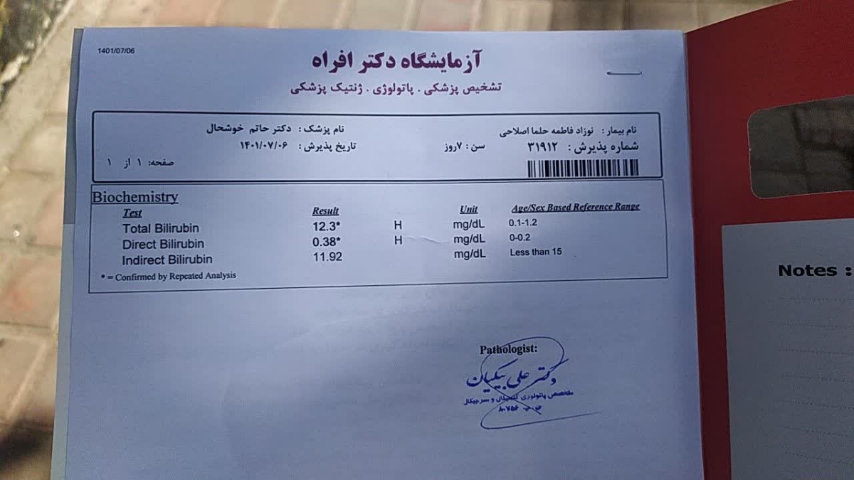 زردی نوزاد هفت روزه زردی نوزاد هفت روزه