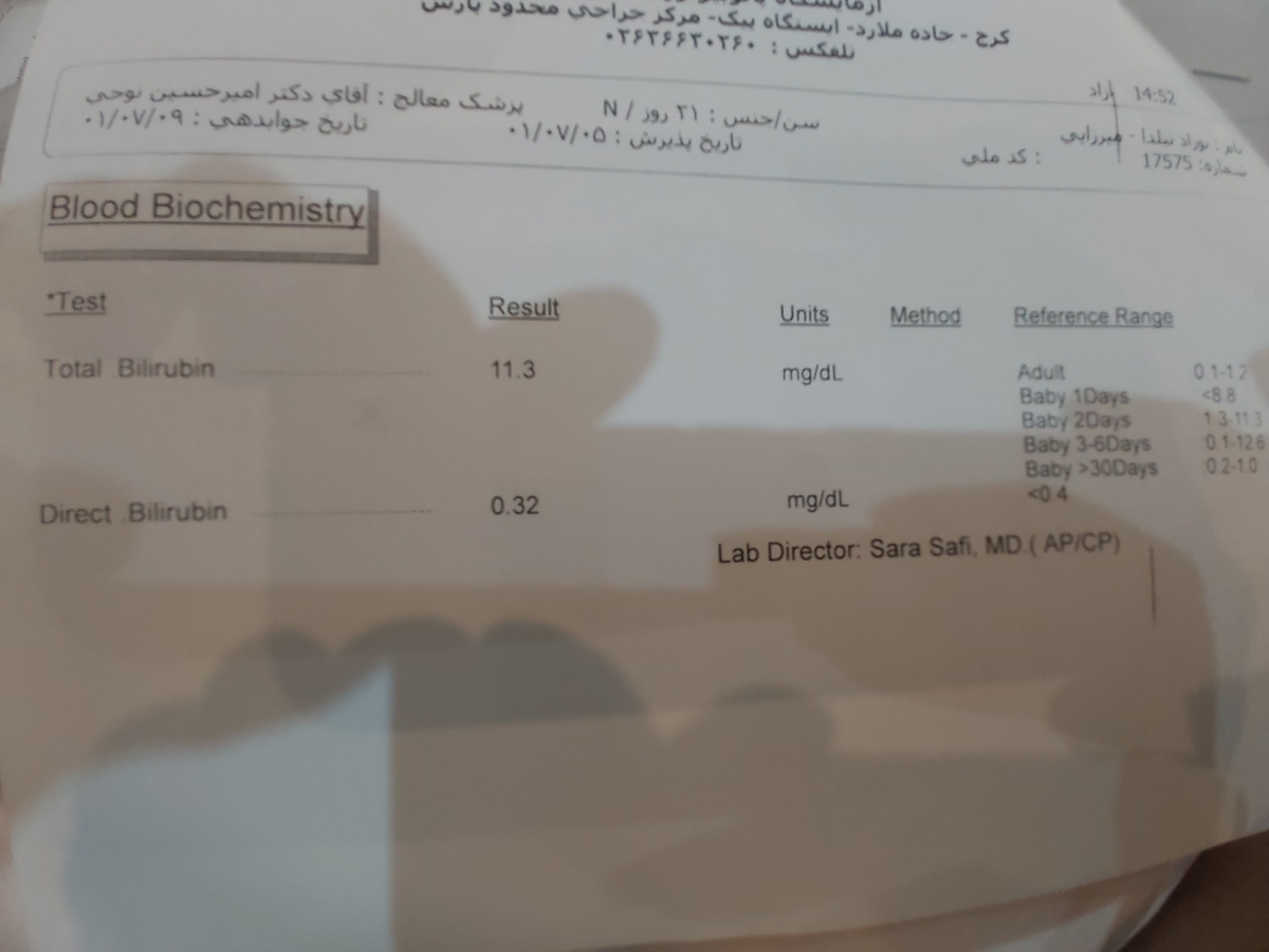 زردی نوزاد و آزمایش تیرویید و ادرار زردی نوزاد و آزمایش تیرویید و ادرار